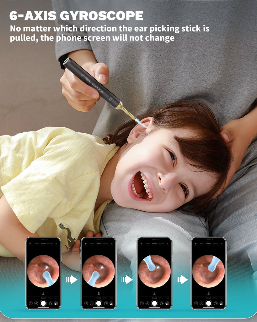 KAUGIC Ear Wax Removal Tool Camera - Premium Ear Cleaner with Camera –  Earokay