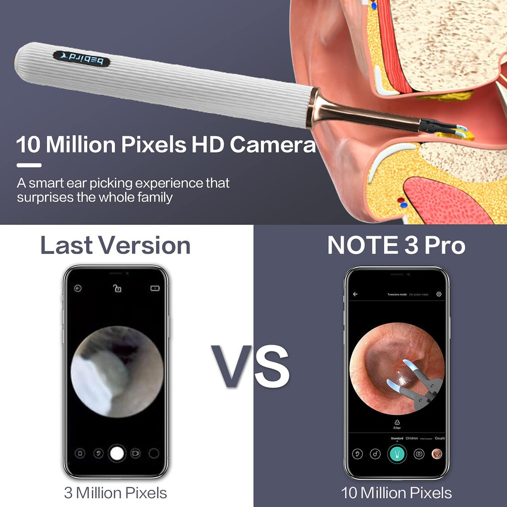BeBird Note 3 Pro Robotic Smart Visual Ear Cleaning Endoscope Tweezers with  Camera 10 MP HD for SmartPhone
