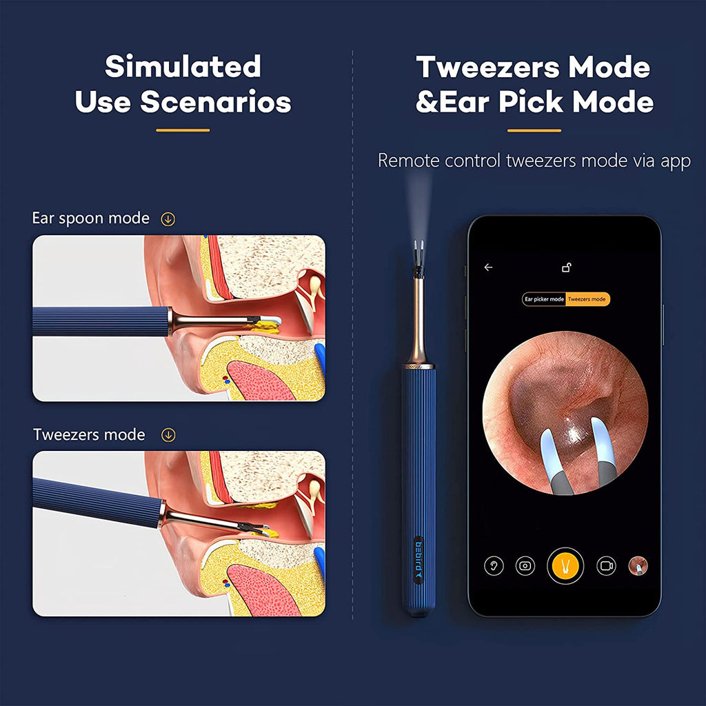 Bebird® Note 3 Pro Visual Ear Camera Cleaner Mechanical Arm Ear Wax Removal