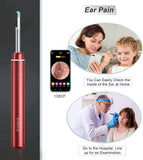 bebird m9 pro - ear wax removal camera endoscope - ear pain