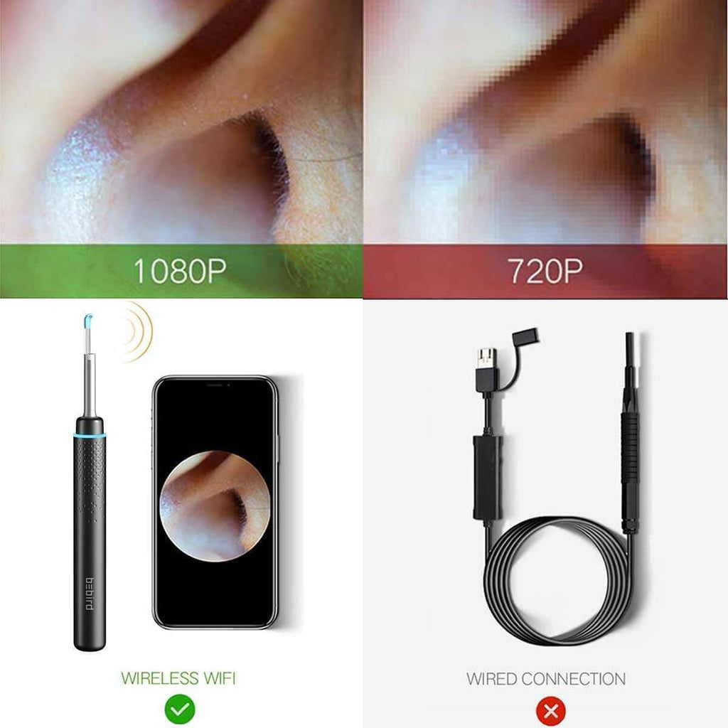 Bebird® M9 Pro Visual Ear Wax Removal Kit, Ear Camera Clenaer Tool